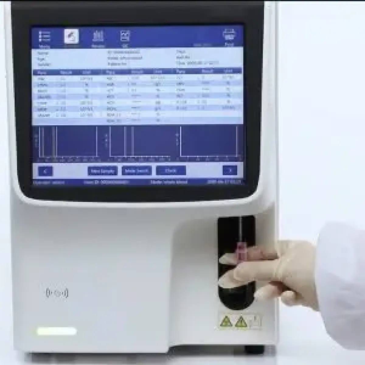 Hematology Analyzer five parts - Image 1